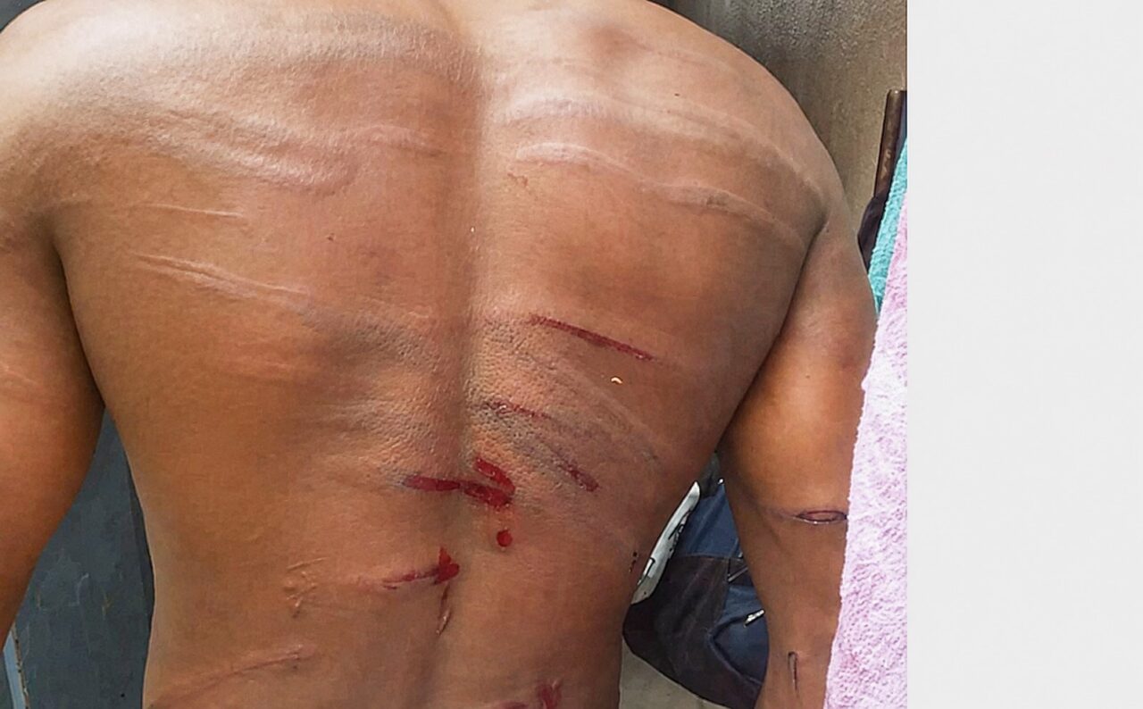 Family Demands Justice After Alleged Military