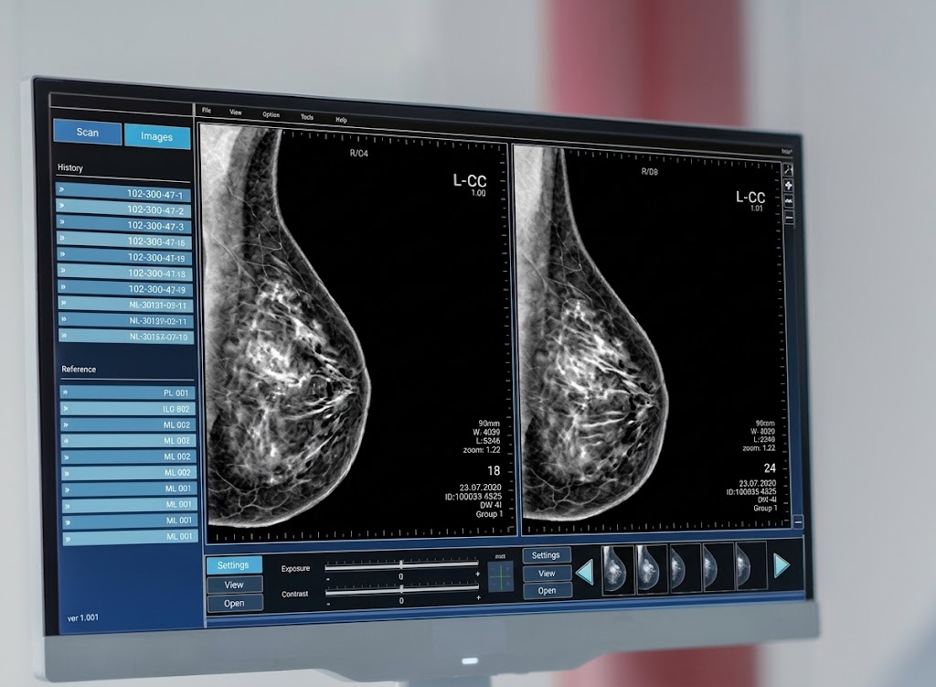 NFA Faces Criticism Over AI Visuals in Breast Cancer Awareness Campaign