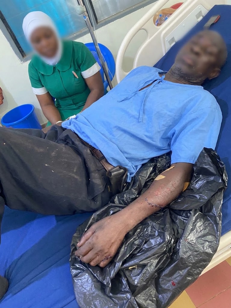 Okada rider loses hand in gruesome attack